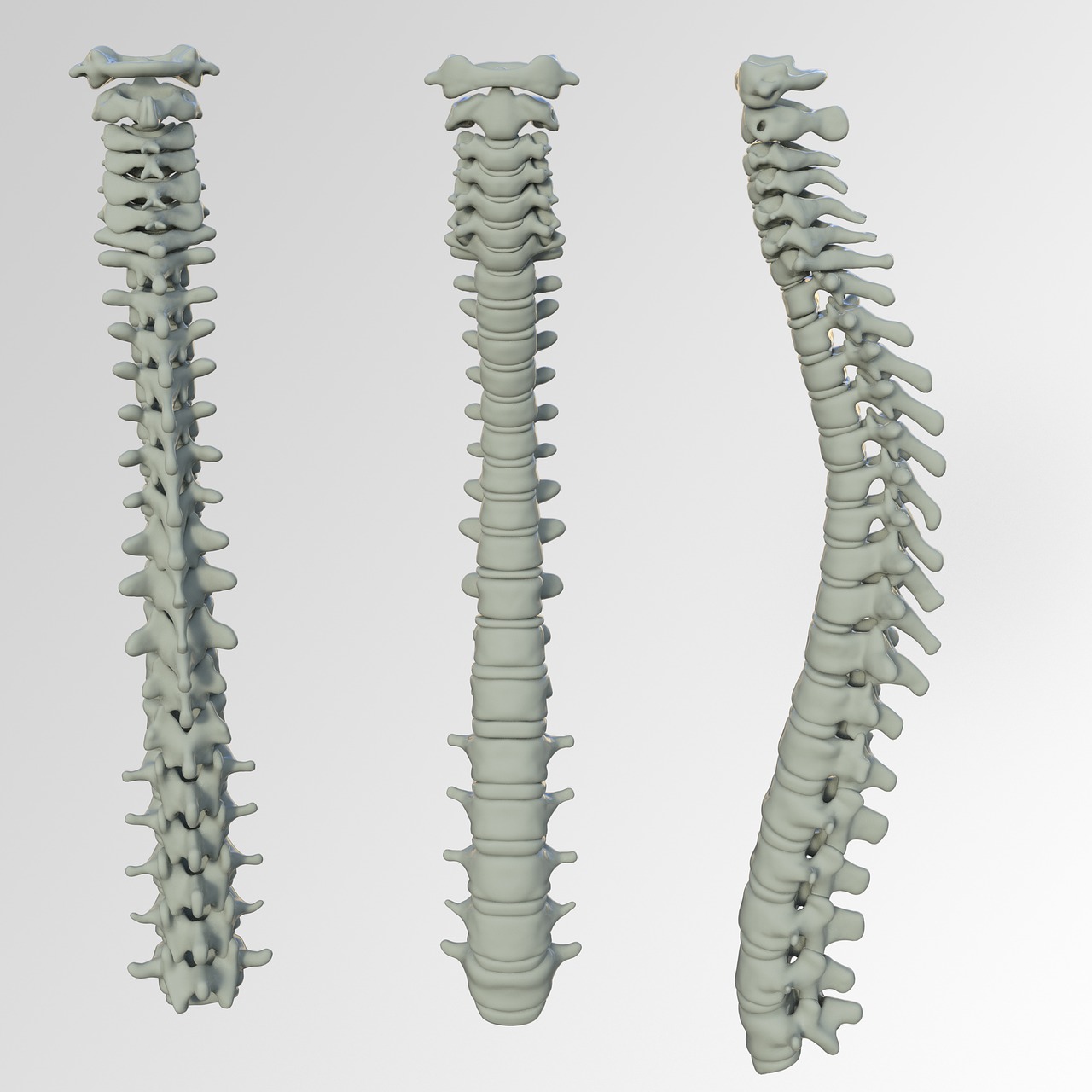 Spinal Screenings Conover, NC